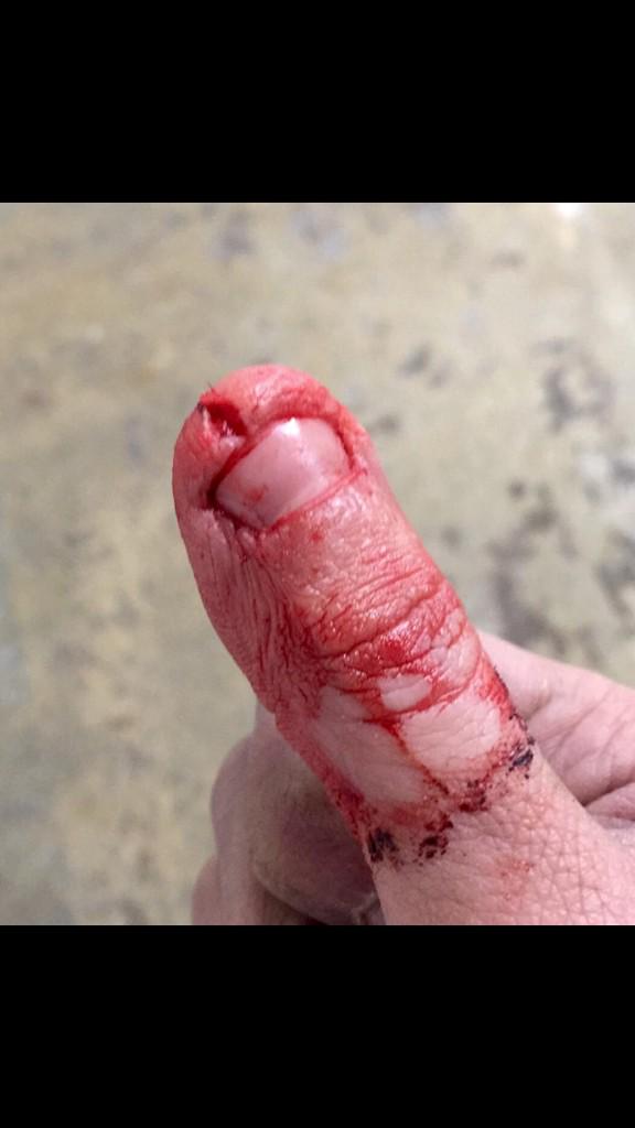 Z_Less4's tweet image. Skate sharpeners can be dangerous when you're stupid.... #TwitterlessRob