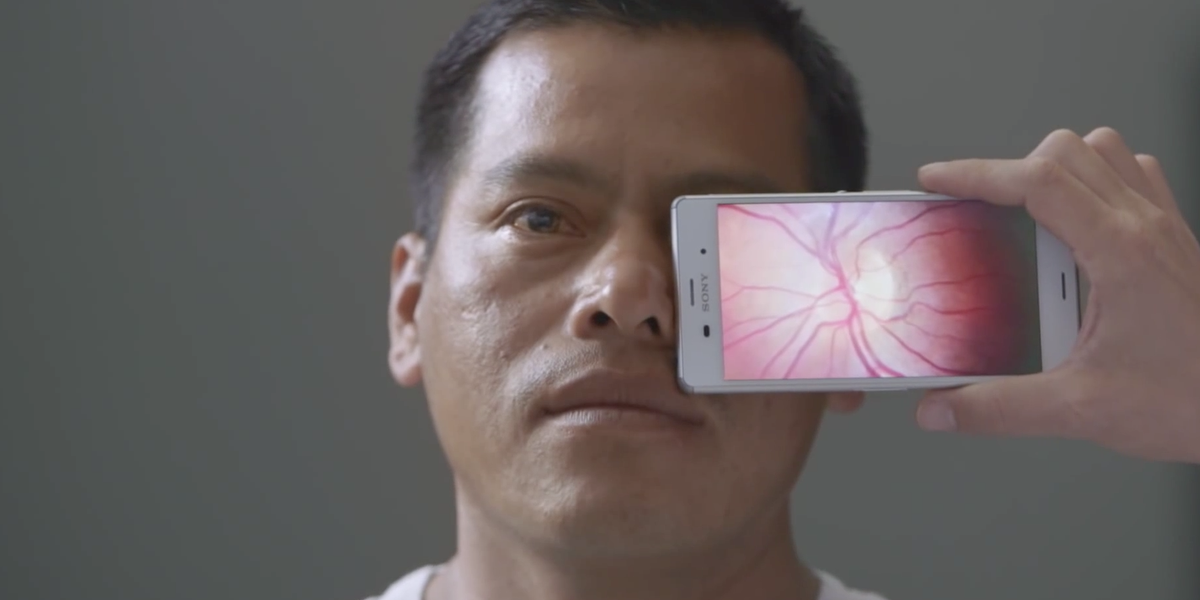 Revolutie in eyecare: oogmeting met smartphone <a href="/oogarts/">Rob Wouters 09039765001</a> <a href="/ziekenhuis/">ziekenhuis</a> <a href="/oxfamnovib/">Oxfam Novib</a> <a href="/AzG_nl/">Artsen zonder Grenzen Nederland</a> 
youtube.com/watch?v=mHS2sR…