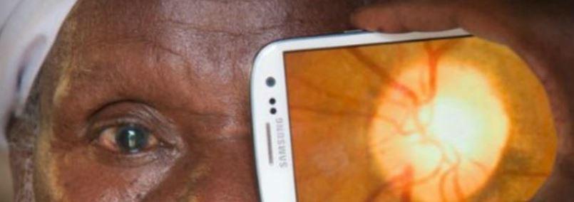 EFFICYCLE_fr's tweet image. Conçu pour les pays pauvres, ce dispositif connecté à un smartphone permet d’examiner l’œil buff.ly/16Cdhq8