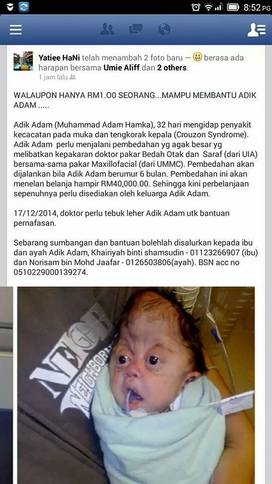 taipanmaster's tweet photo. Bantu la anak ini walaupun RM1 @NajibRazak @TengkuAdnanReal @Khairykj @azwanbro @ZahidaZarik tolong rt kalau prihatin http://t.co/EZfotvIhfR