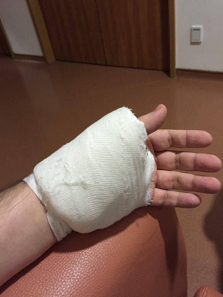 фото перевязанной