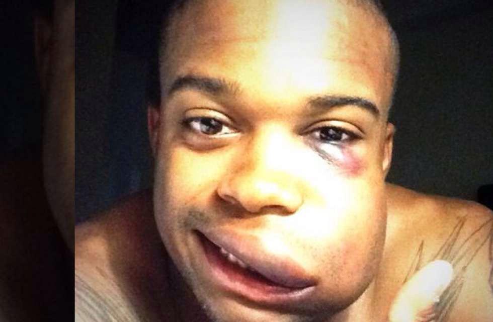 NotJerryTipton's tweet photo. Chris Jones after the game. Man, I hope he's OK. #PrayforChrisJones http://t.co/QYss2k4Mxk