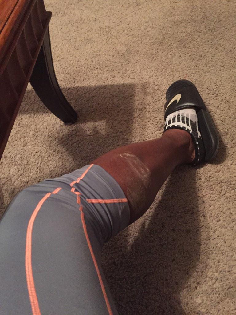 DoseofDrMeesh's tweet image. #ThrowersProblems