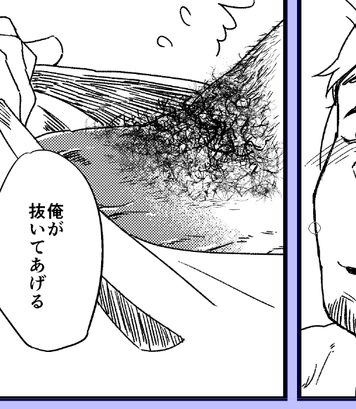 チン毛すぎる? 