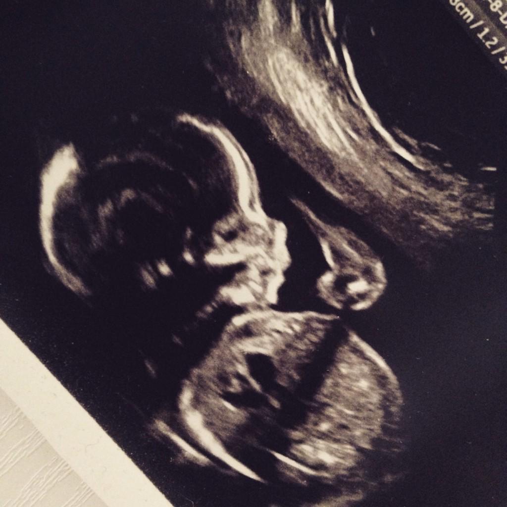 Aled's tweet image. I just noticed that in an earlier ultrasound scan, Macsen is using a touch screen device. #soadvanced