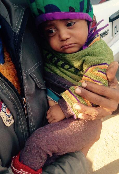 This angel needs help.Let's save a life. dfyusa.org #everypennycounts #smallchildrenbigsmiles #giftoflife