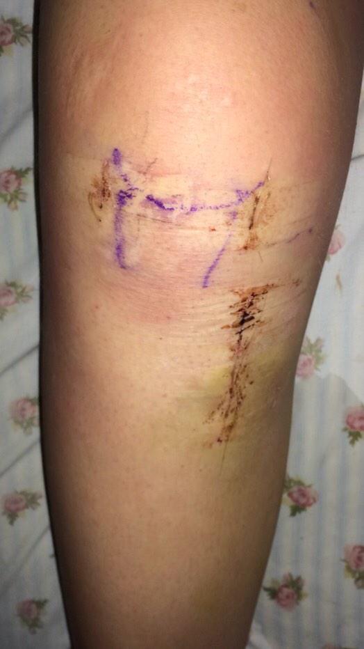 aclhelp tweet picture