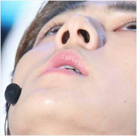 _AeyCYeol's tweet photo. เซฮุนดัดฟันแบบนี้ http://t.co/NYUblps2lW