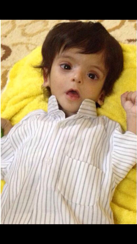 تكفون#رتويت ماتخسرون شي
دعوه في ظهرغيب اللهم ماعجز عنهُ الأطباء
أنت رب الأطباء لايعجزك شي!

#دعوه_ل_ولد_كريزي_الهلال