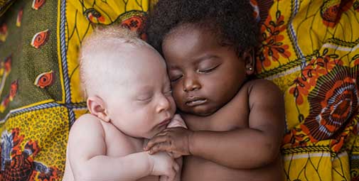 HealthDigests's tweet image. These photos with make you think - imgur.com/a/Zd7Gu