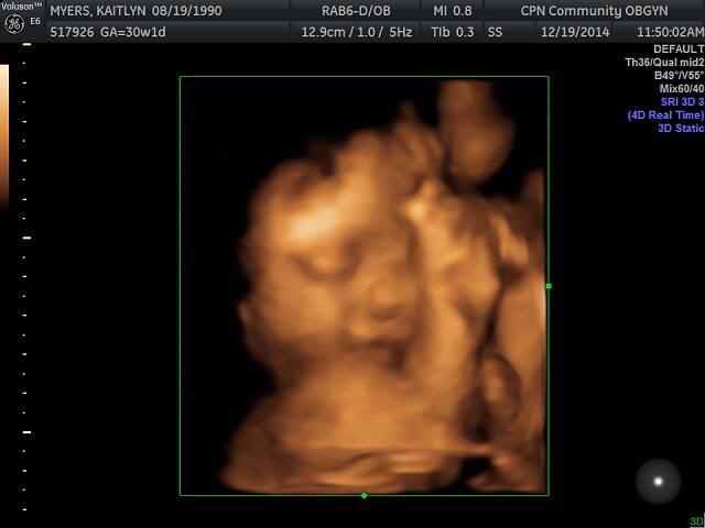 srhmyrs's tweet photo. two months and a day till this little love makes her appearance 😍😍 #62days #EverlyKay http://t.co/aZud7bTXaK