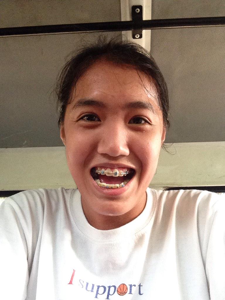 benneeeeette's tweet image. Jogged at UP D. #kapoy