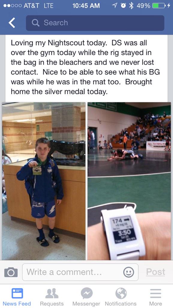 WeAreNotWaiting's tweet image. Mom got #Nightscout, he got Silver. #FreeOpenSourceSoftware #WeAreNotWaiting #Pebble Nightscout.info