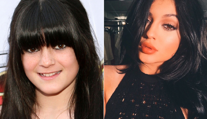 VH1's tweet photo. Did Kylie Jenner have plastic surgery? Peep these throwback photos + see for yourself --> http://t.co/FT4OGkqXtQ http://t.co/pJz6hgSSdT