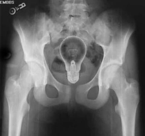 poopmotivation's tweet photo. Your ass can get good ideas, too. http://t.co/RVbtXrfHKi