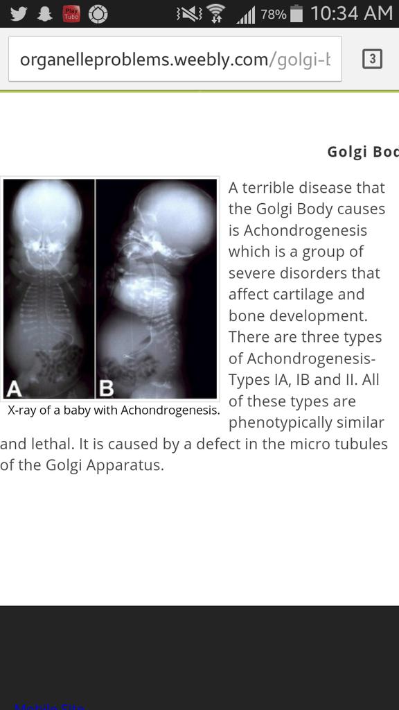 mightymitch15's tweet photo. @goodgooglygolgi Achondrogenesis AND Alzheimer's?? The golgi body is REALLY capable of messing things up #AHSOIC15 http://t.co/OpKx7h5Xh9
