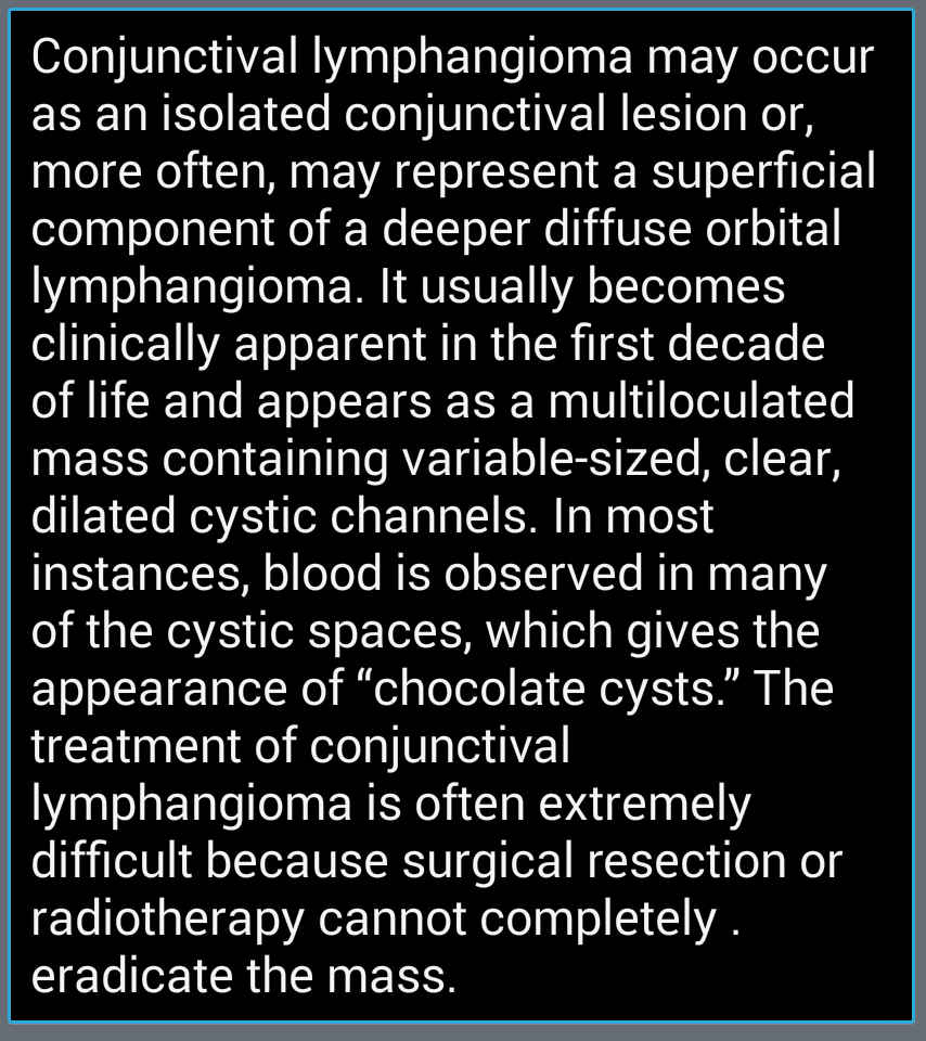 A prospective study of the role of intralesional bleomycin in orbital  lymphangioma, image size:854x960