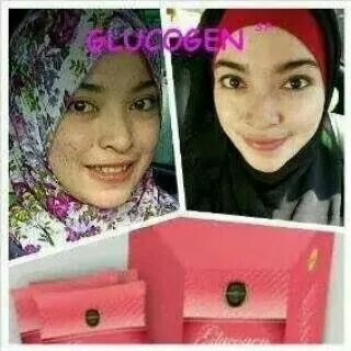 rini_apijah's tweet photo. GLuCoGen solusi kulit sehat alami :)
more info 75AC4D8E / wa 087717971317 http://t.co/0frynDaq6c