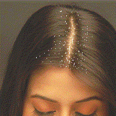 greatlookinghai's tweet photo. Dandruff and Dry Itchy Scalp Trouble Shooting - http://t.co/RHO6TRCeXP http://t.co/zILmaSqkgv