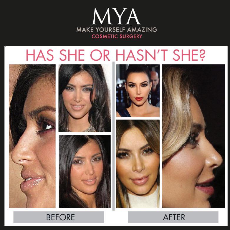 taralf_x's tweet photo. “@MYA_Tweet: @KimKardashian has she or hasn't she? 👃 #MYA http://t.co/Np2RFUwiHK” haha, I was thinking this earlier! Matching with her mum x