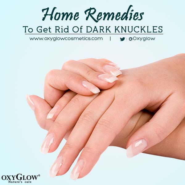 Oxyglow's tweet photo. Check out the amazing home remedies to get rid of dark knuckles by clicking here http://t.co/f6vg2PvzI2 http://t.co/mSZxbCJxOg