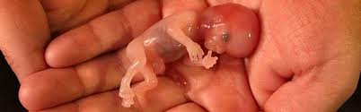 javier_gr77's tweet image. "@RadioMariaSpain: En #España 108.690 seres humanos ha sido #abortados durante el año 2013. http://t.co/WjCzPJ5erv" recemos por ellos.