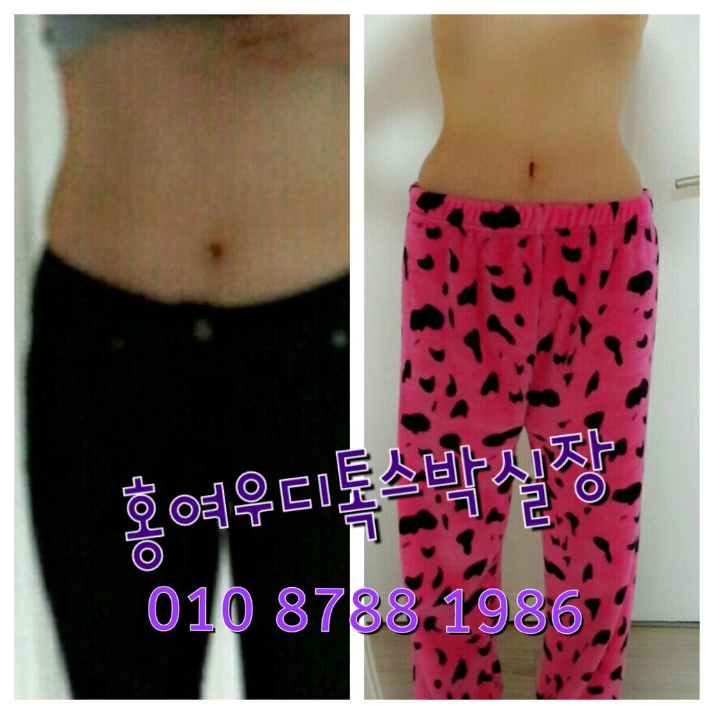 #나의_신년소원을_말해보자 
#다이어트 ? #홍여우디톡스 는 다이어트약이아닌 건강기능식품으로 FDA , 승인난 식품이에요~^^운동으로 빼기힘든 체지방 #디톡스 로 #독소 빼고 건강해지세요