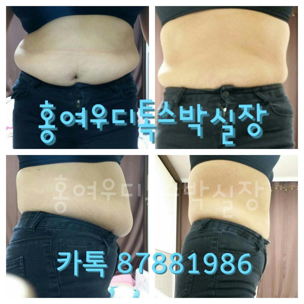 #나의_신년소원을_말해보자 

hongfox78.com
더많은 후기 ♡

#디톡스 는 #해독 입니다
새해 #건강 해지고 #다이어트 되는 #홍여우디톡스 하세요♥
#삼일디톡스 #고객후기