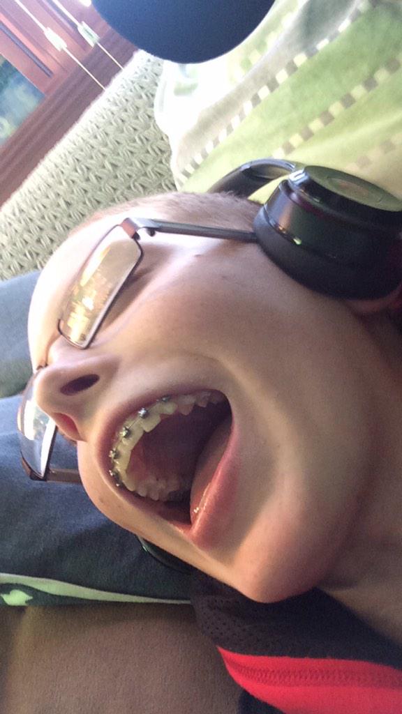 DailyGing's tweet image. When you go all summer without getting sunburned #SPF500