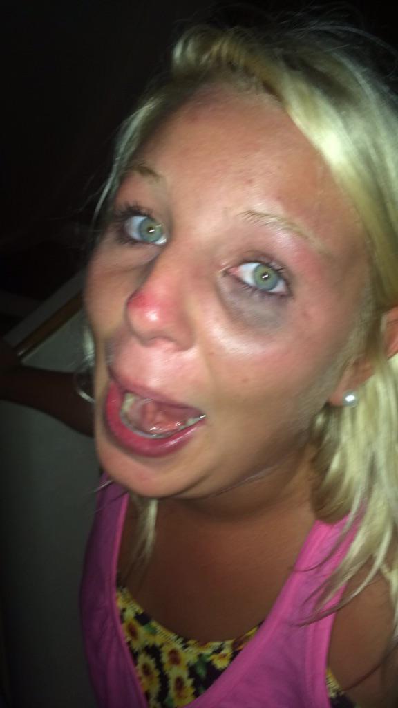 kellbell_kboxx's tweet photo. Gabby fucked up in 2014, lets home she does better in 2015 #ebolasurvivor #scabiessurvivor http://t.co/SZjYlywFjo