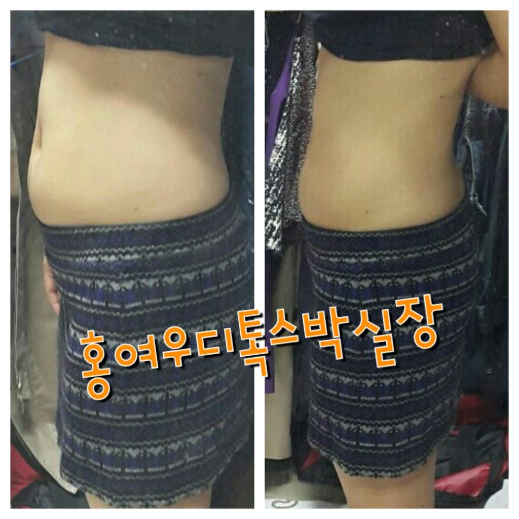 #2015_새_나이 
#새해소원 은 #다이어트 ♡
삼일이면 okay ♡.♡
운동안해요
물마니 마셔 설사하는 #디톡스 아닙니다
유지제품도 없어요
문의환영합니다 010 8788 1986
카톡 87881986