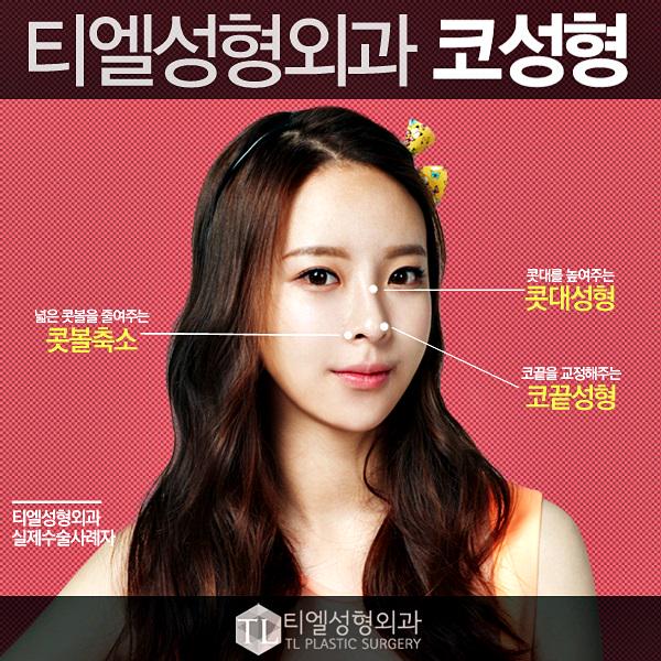 tl7667's tweet photo. ♥ 티엘성형외과 코성형 ♥
클래식에 충실하다! 기본일수록 중요한 눈코성형 http://t.co/NfVg3J9nNp