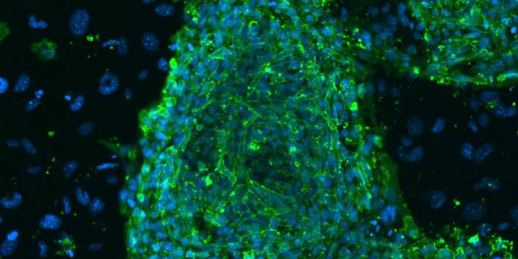 foxandfriends's tweet image. Study concludes that many cancers caused by 'bad luck' in cell division fxn.ws/1xcXmsB