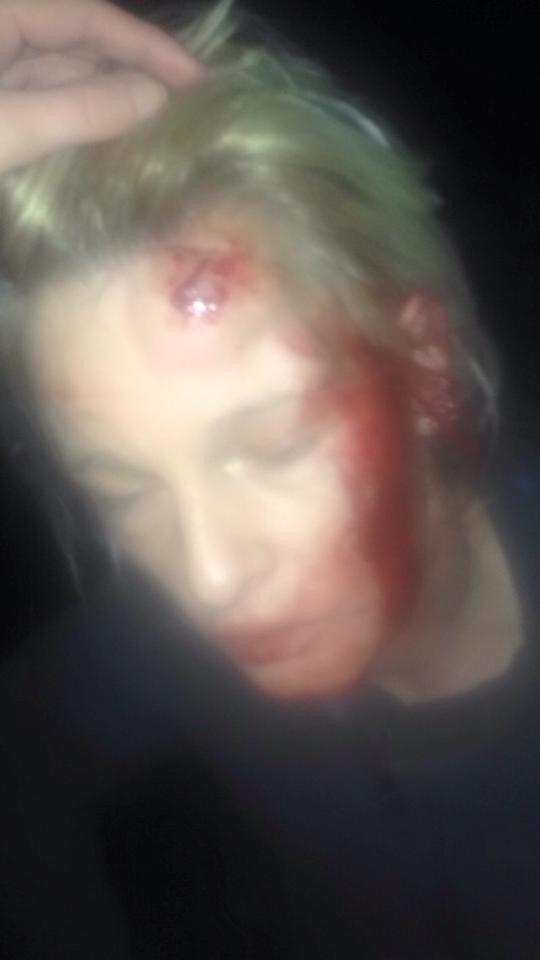 Geezajay2013's tweet photo. This Is What 2 Men Done To A Mum Who Was Protecting Her Daughter Who They Tried Getting Her In A Car In #Bradford http://t.co/gaZQ7QmxSI