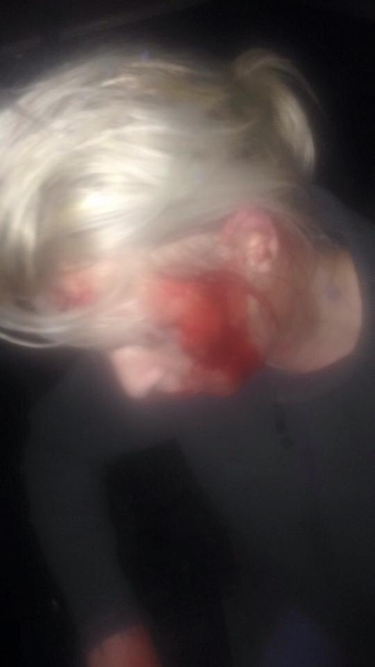 Geezajay2013's tweet photo. This Is What 2 Men Done To A Mum Who Was Protecting Her Daughter Who They Tried Getting Her In A Car In #Bradford http://t.co/gaZQ7QmxSI
