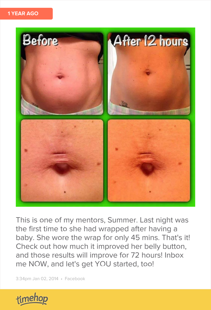 StephsWraps's tweet photo. Love Summer's wrap results! http://t.co/sbhz6TJzjb http://t.co/eePO8fobdp