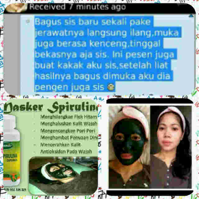 OutletHerbalcom's tweet photo. Testimoni Masker Spirulina. Jerawat+Flek+Masalah Kulit minggat! :) mau? Invite PIN BB 57F6CA53 WA 085722481650 https://t.co/yyBBPIignO