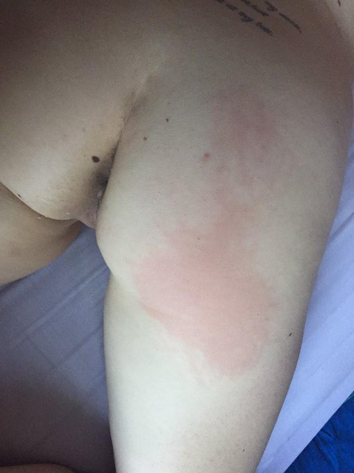 I've reached 100 followers!! Wooooh!! Have a picture of my spanked ass after a good fuck as a thank you<a href="/tag/camgirl"class="tags"><span>#camgirl</span></a><a href="/tag/manyvids"class="tags"><span>#manyvids</span></a>