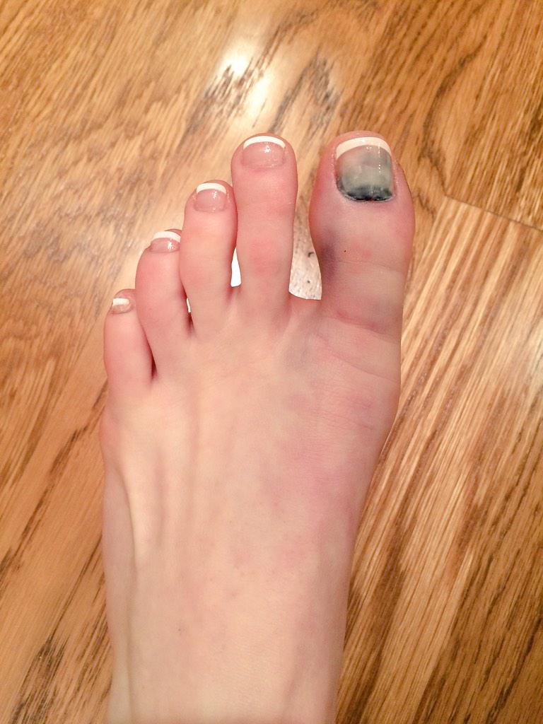 saybrownell's tweet photo. Props to the nail ladies for trying😂 #gymnastprobs http://t.co/EKTGqLlYJx