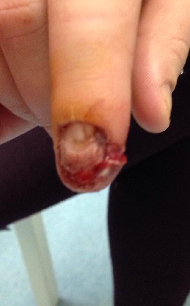 KatieSanders9's tweet photo. @jennebell2 stop being dramatic #PrayForKatiesFinger http://t.co/peKWJ6OuO6