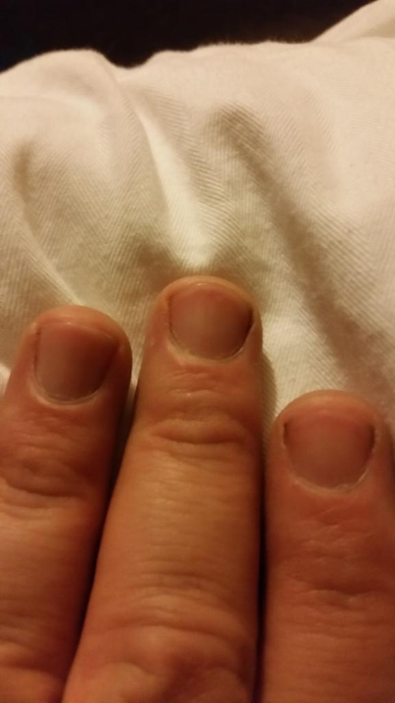 Supermanracing's tweet photo. @ReddWhiteBlue2 @NASCARZak @MeDaSuperman @Whitney_Tip short fingernails... #manicureproblems http://t.co/75U94lHas7