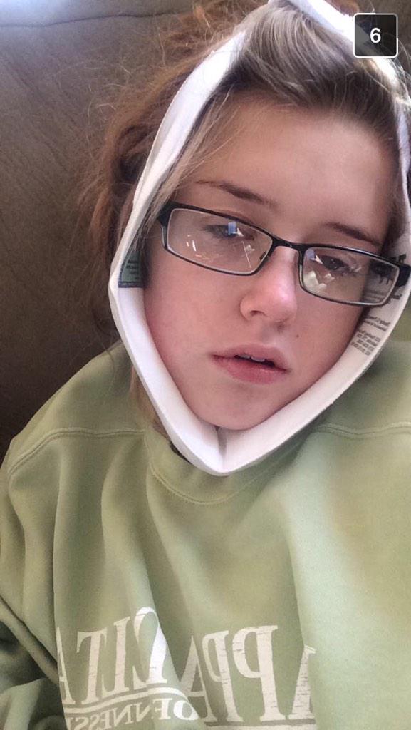 leahriderrr's tweet photo. Miss my wisdom-toothless bff already 💔 http://t.co/LpQElK19fJ