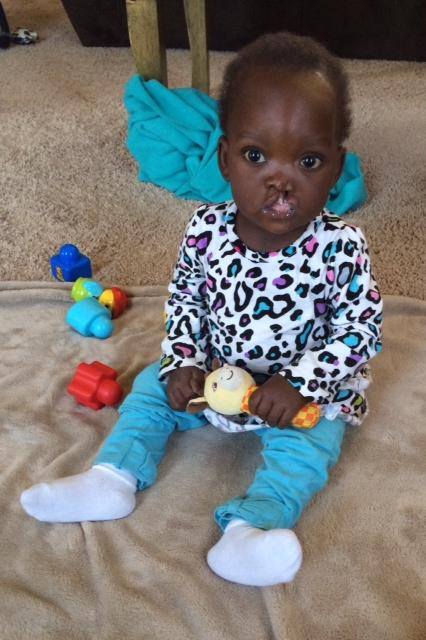 Grace before surgery