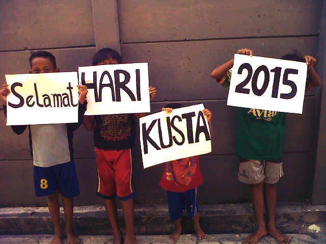 SahabatKusta's tweet photo. #HappyWorldLeprosyDay #LINKSOS http://t.co/1KODnVGpjj