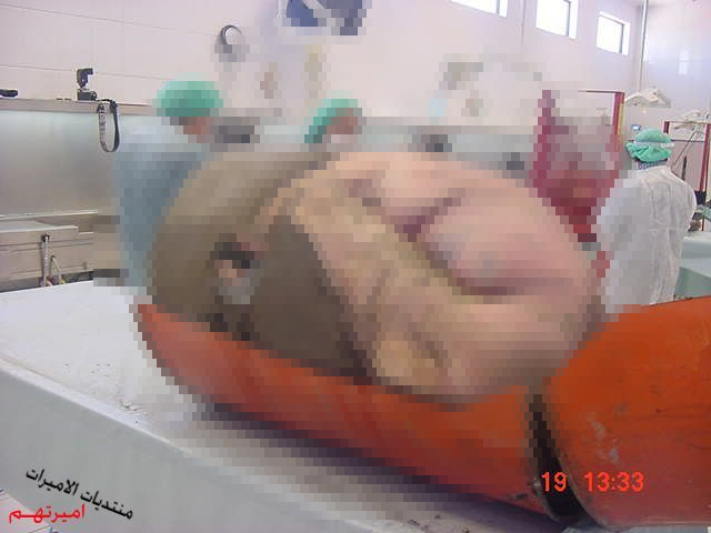 afiducoFre's tweet photo. 【衝撃】
ドラム缶の中にコンクリ詰めらにされて殺された死体

ドラム缶を解体して中から出てきたのは衝撃的な変わり果てた姿だった・・・

閲覧注意モノ
⇒http://t.co/1qYBtCHc17 http://t.co/z0C8L1LDqr