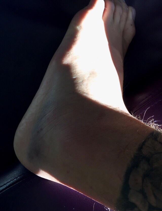 Our baby broke his foot #GetWellSoonJustin #HollywoodMusicAwards Justin Bie...