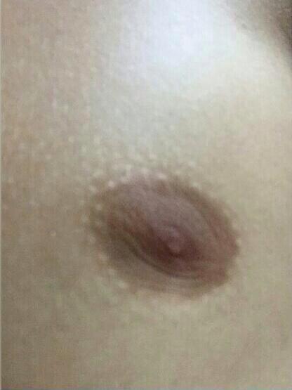 KeylaKeylarm's tweet photo. Hi I'm Justin's Nipple#WeAllAreJustinsNipple http://t.co/N3iOtuMfnz