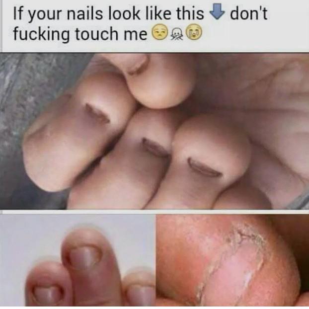 MEME'D YA - The toe touching kind of unnerves me