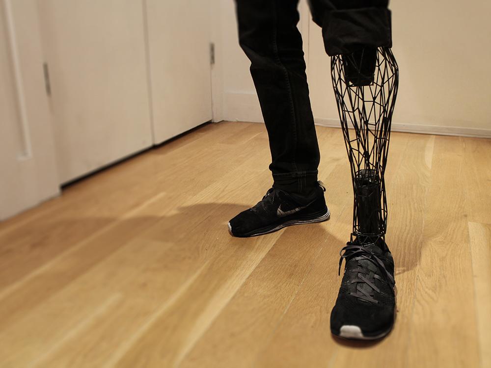 WIRED's tweet photo. 3-D printed prosthetics that look fit for a sci-fi warrior http://t.co/h65b7oI5WF http://t.co/715oVuPi50