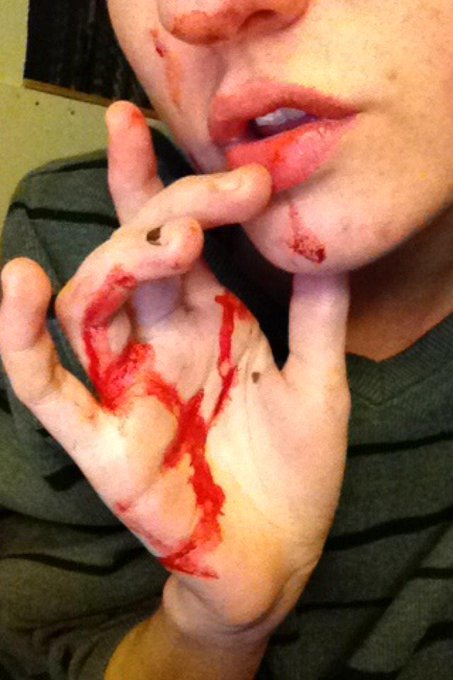 Cant say wakin up to blood all over my face an hands wasn't a little surprising. 😛 #BloodyFreak #BloodyHell<a href="/tag/bloodyhell"class="tags"><span>#bloodyhell</span></a><a href="/tag/bloodyfreak"class="tags"><span>#bloodyfreak</span></a>